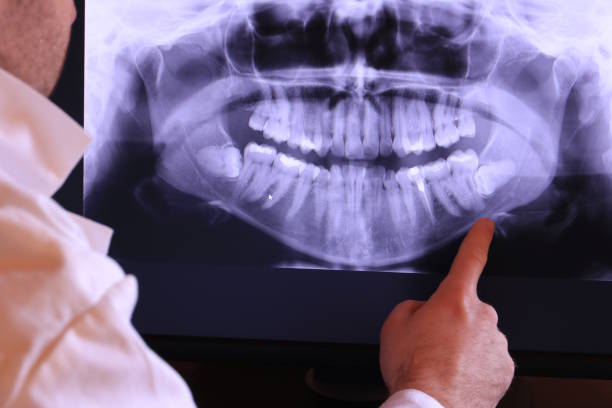 Best Cracked Tooth Emergency Dentist  in Sebring, FL